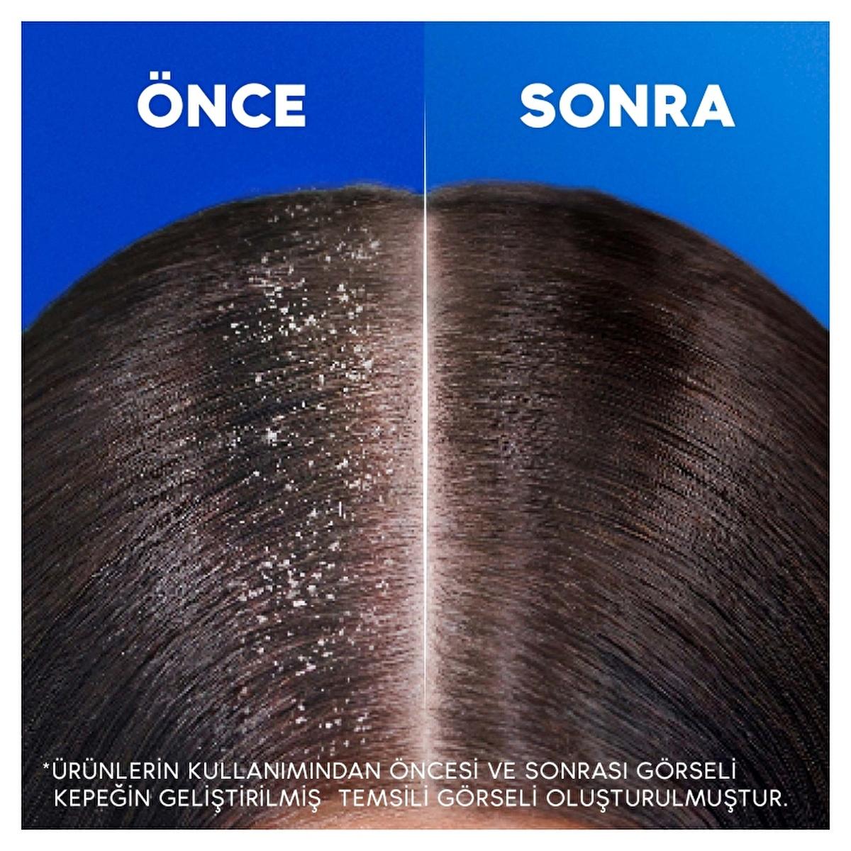 Head & Shoulders Anti-Dandruff Shampoo for Women - Combats Hair Loss & Dandruff, Dermatologically Tested, Sustainable Packaging